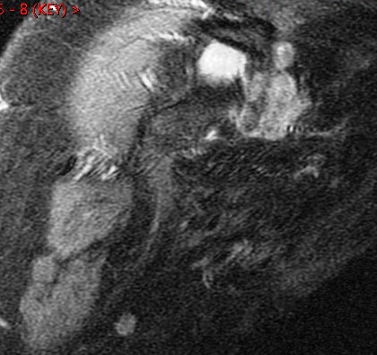 Figure 4 for case Gout ( RID3567 )